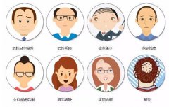 拿什么拯救你----我的头发？