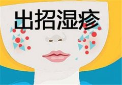 [吕梁湿疹医院]湿疹是不是就是过敏？