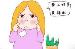 如何做“无斑”女神？太原九州帮你实现