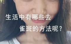 如何吃掉色斑？小编推荐祛斑饮食小妙招